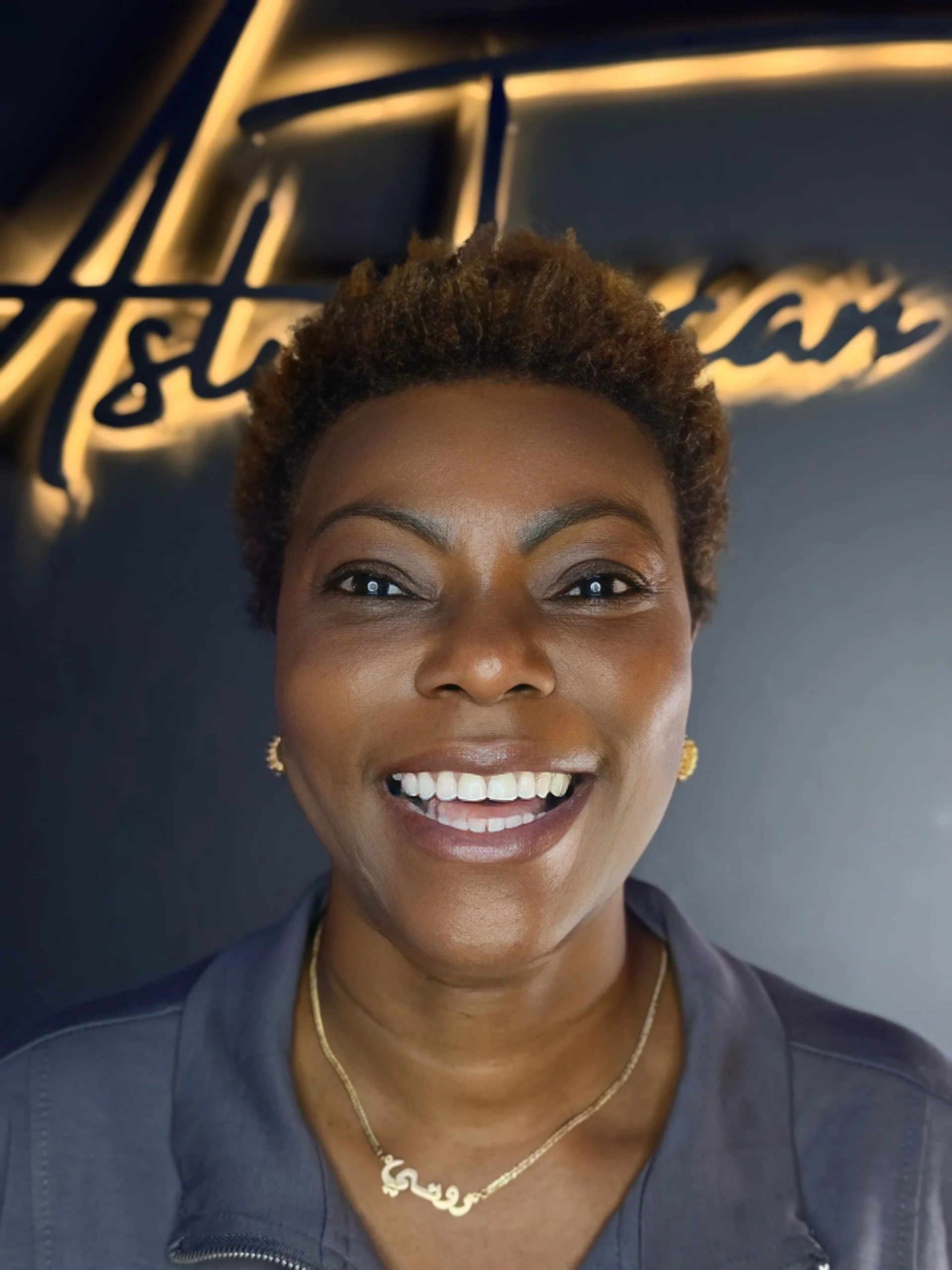 3 female hair transplant