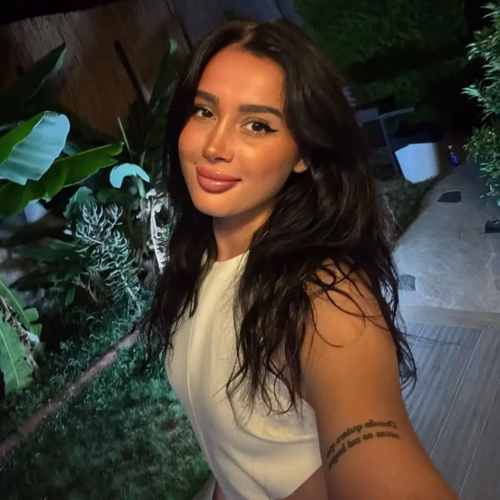 11 final result of revision rhinoplasty at asli tarcan clinic